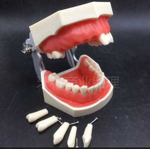 IP0024  치과 치아 이빨 이 잇몸 충치 모형