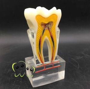 IP0005  치과 치아 이빨 이 잇몸 모형