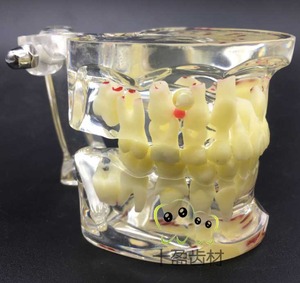IP0008  치과 치아 이빨 이 잇몸 모형