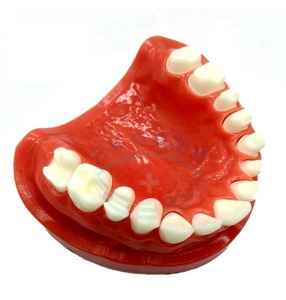 IP0012  치과 치아 이빨 이 잇몸 충치 모형