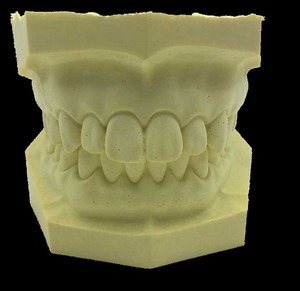 IP0015  치과 치아 이빨 이 잇몸 충치 모형