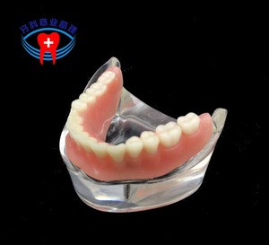 IP0013  치과 치아 이빨 이 잇몸 충치 모형